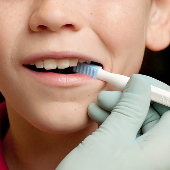 ΛΑΒΗ ΣΤΟΜΑΤΟΚΙΝΗΤΙΚΗΣ ΘΕΡΑΠΕΙΑΣ ARK'S PROBE