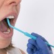 ORASTIM® ORAL STIMULATOR