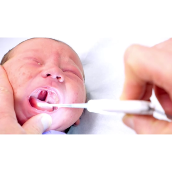 ΦΑΡΥΓΓΟΣΚΟΠΙΟ THROAT SCOPE