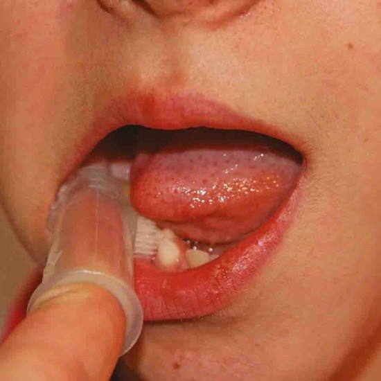 ΔΑΚΤΥΛΙΚΗ ΟΔΟΝΤΟΒΟΥΡΤΣΑ – TINY TEETHER