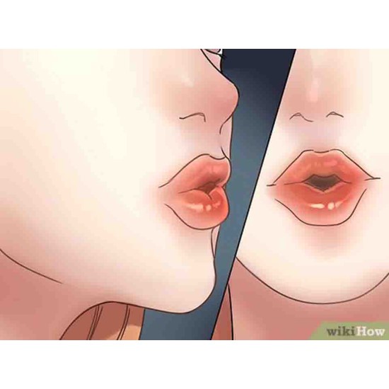 ΣΦΥΡΙΧΤΡΑ ΣΤΟΜΑΤΟΜΥΪΚΗΣ ΕΝΔΥΝΑΜΩΣΗΣ WHISTLE LIP